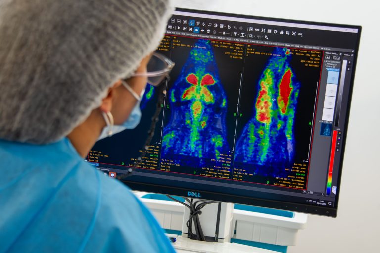Más de 7.000 estudios PET fueron realizados en el Cudim en 2025